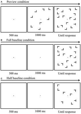 A Drastic Change in Background Luminance or Motion Degrades the Preview Benefit